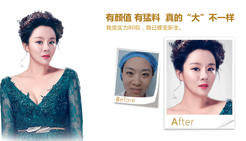 新乡脂肪移植、隆鼻