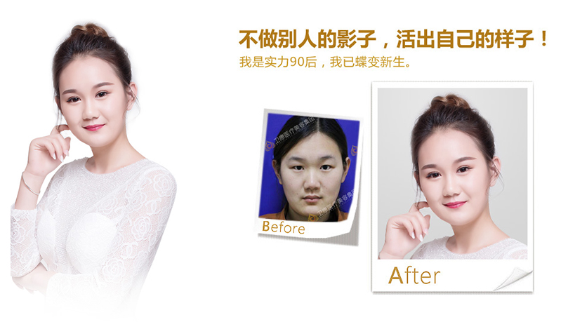 新乡纳米脂肪移植