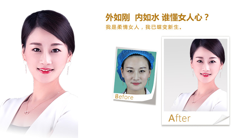 新乡V脸、线雕隆鼻